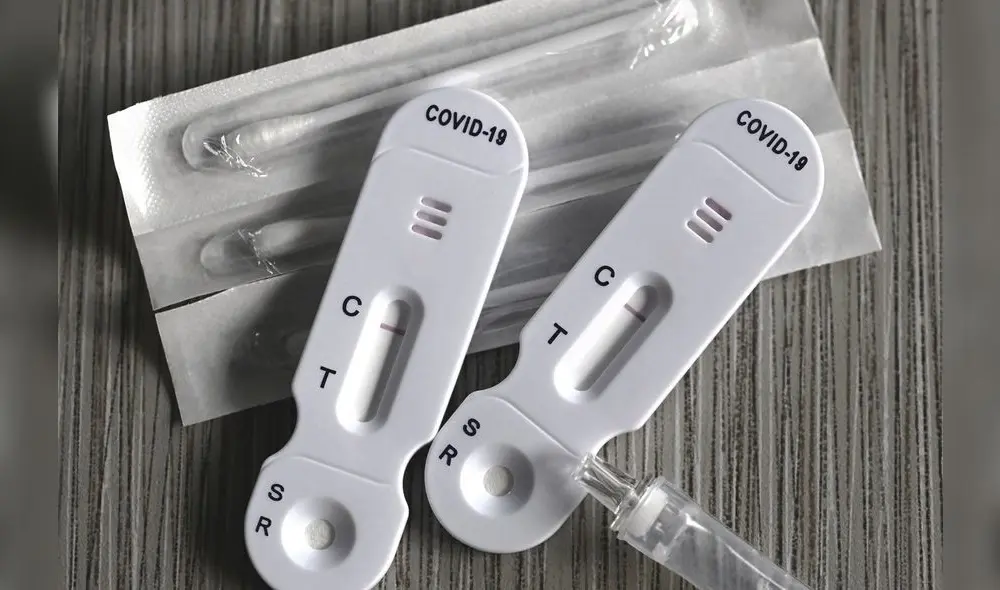 Test rápido de COVID-19 no brinda resultados precisos. Foto: Andina