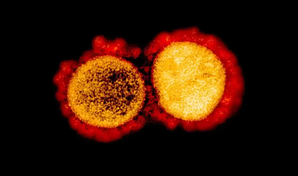 Según la plataforma Outbreak, el sublinaje BA.2 de ómicron se ha detectado en al menos 74 países del mundo, incluido el Perú. Foto: NIAID