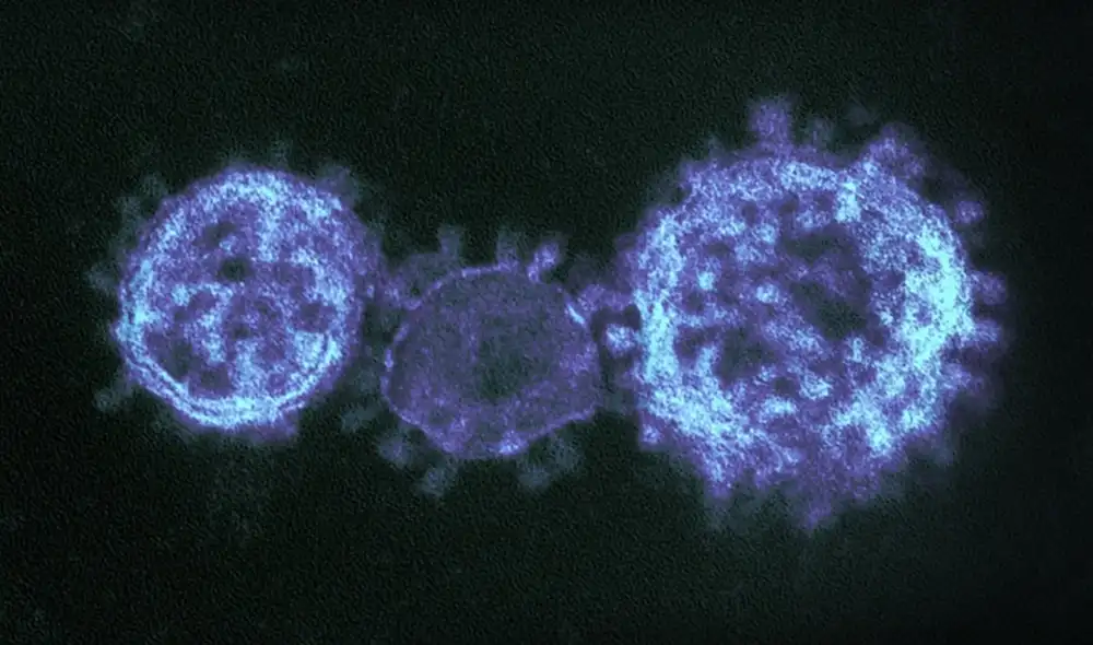 El coronavirus SARS-CoV-2 posee una capacidad para volverse indetectable ante la respuesta inmune humana. Foto: NIAID