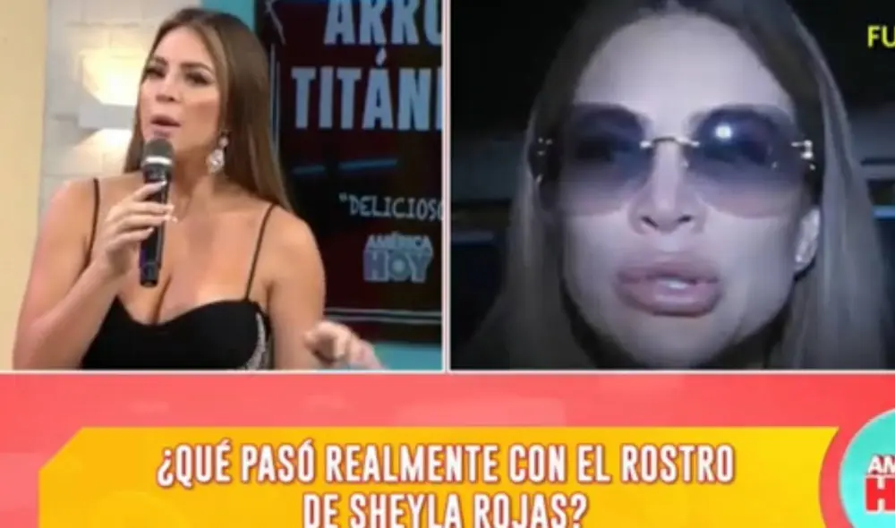 Sheyla Rojas reveló que se encuentra en terapia para superar parálisis facial. Foto: captura de América TV Sheyla Rojas reveló que se encuentra en terapia para superar parálisis facial. Foto: captura de América TV