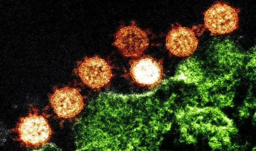 A medida que el coronavirus SARS-CoV-2 se propaga entre sus huéspedes, va acumulando mutaciones que lo vuelven muy distinto a sus predecesores. Foto: NIH