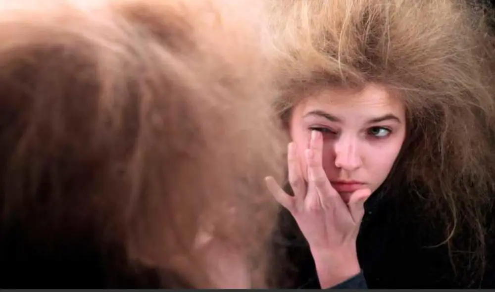 La cura para el síndrome del cabello impeinable no existe, pero se espera que en los próximos años los avances de la ciencia logren encontrar una solución. Foto: IBTimes