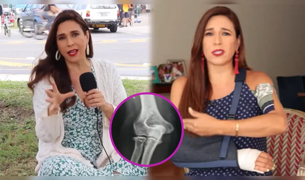Verónica Linares recordó que no es la primera vez que sufre una caída en el parque en el que se accidentó el brazo. Foto: composición/Verónica Linares/Instagram/YouTube Verónica Linares recordó que no es la primera vez que sufre una caída en el parque en el que se accidentó el brazo. Foto: composición/Verónica Linares/Instagram/YouTube