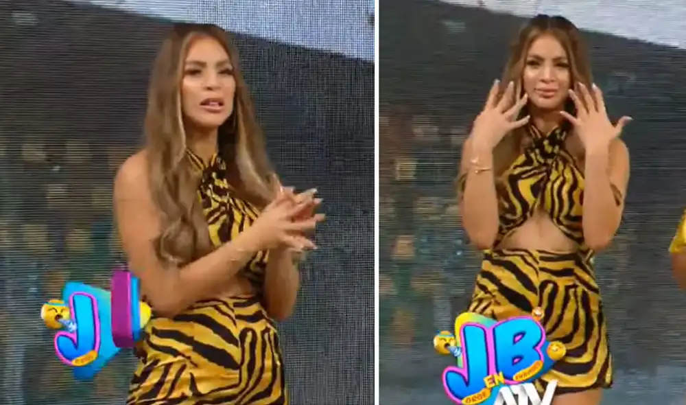 Sheyla Rojas aseguró que no fue el ácido hialurónico lo que provocó su parálisis facial. Foto: captura ATV