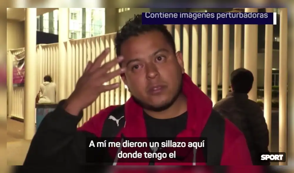 Un herido reveló que los aficionados de Querétaro contaban con elementos punzocortantes. Foto: Diario Sport