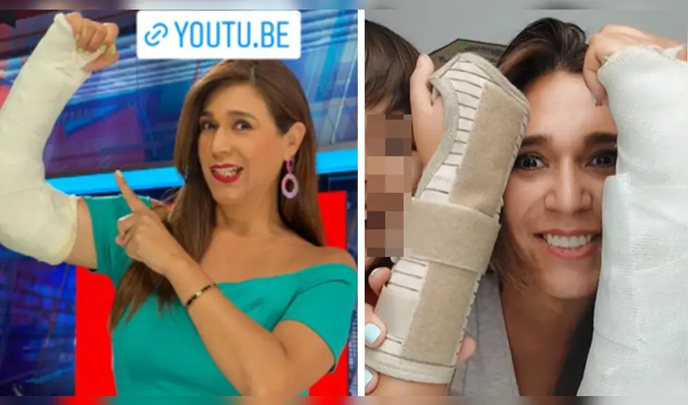 Verónica Linares tiene enyesado su brazo izquierdo, mientras que Fabio tiene una lesión en su extremidad derecha. Foto: composición/Instagram Verónica Linares tiene enyesado su brazo izquierdo, mientras que Fabio tiene una lesión en su extremidad derecha. Foto: composición/Instagram