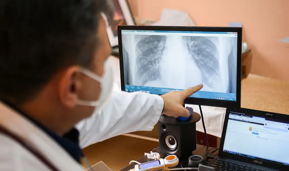 Científicos detectaron la enfermedad de las vías respiratorias pequeñas en pacientes con COVID-19 persistente. Foto: referencial / AFP