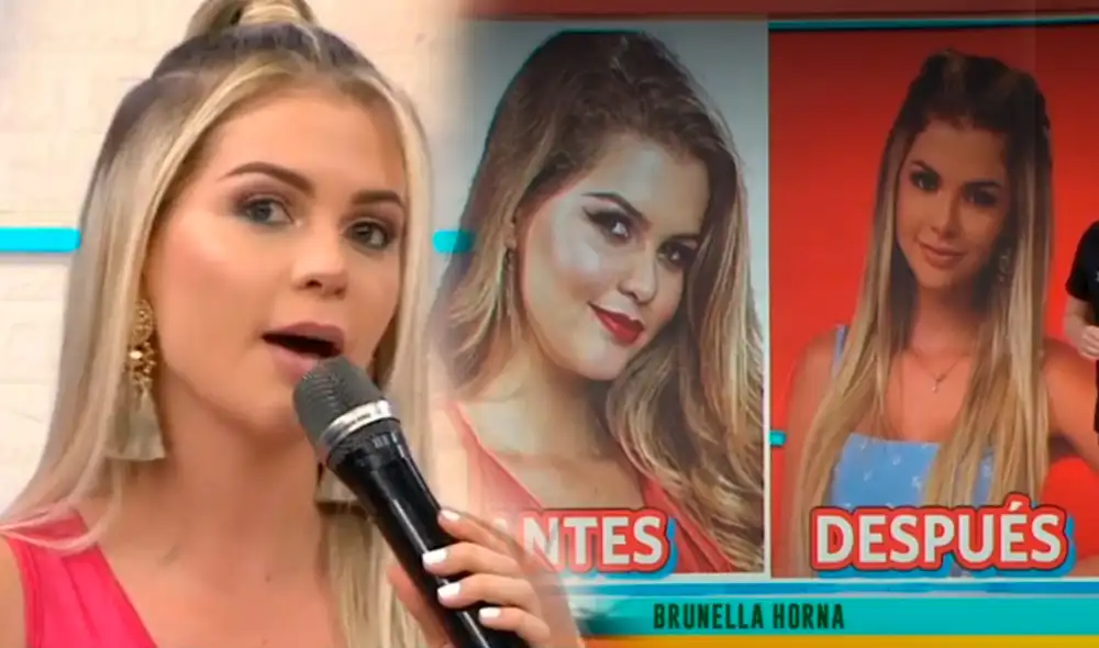 Brunella Horna habló del momento que vivió a los 18 años cuando le operaron el busto. Foto: captura/América TV Brunella Horna habló del momento que vivió a los 18 años cuando le operaron el busto. Foto: captura/América TV