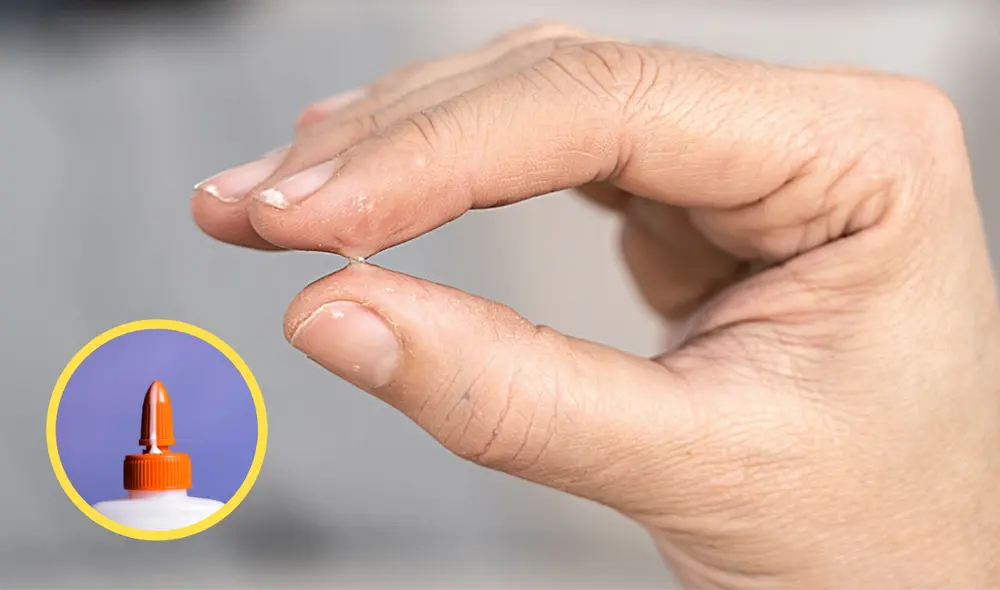 Consejos para quitar cola u otro pegamento de la piel en simples pasos. Foto: composición de LR/ Loctite