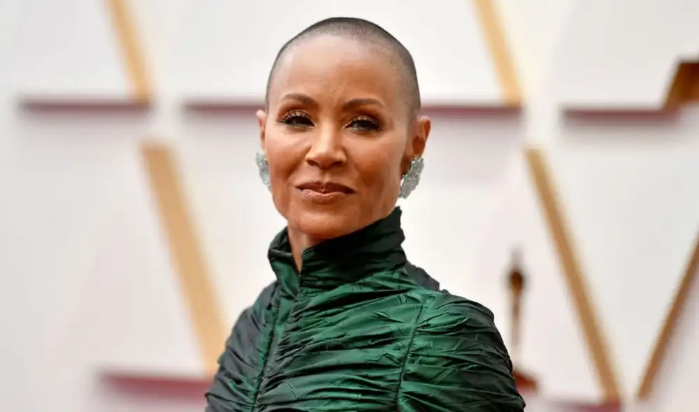 El factor genético es una de las causas de la alopecia en las personas. Foto: AFP El factor genético es una de las causas de la alopecia en las personas. Foto: AFP