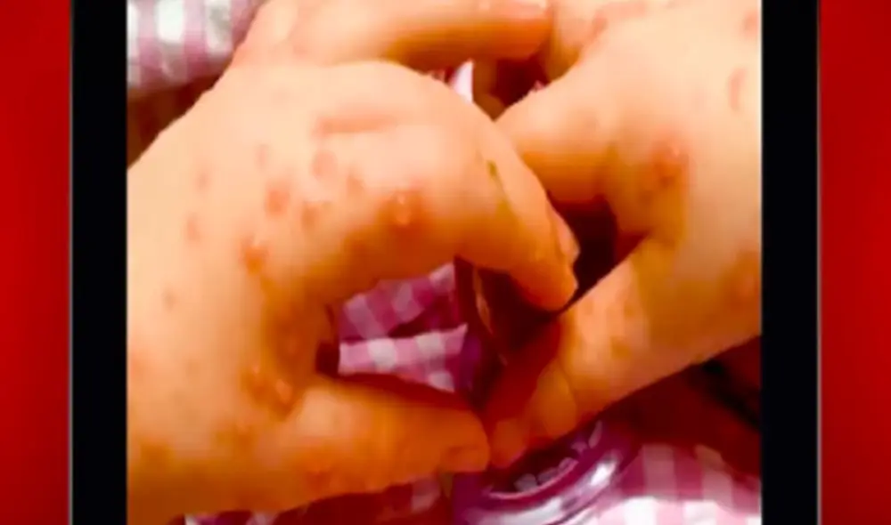 Autoridades de la salud exhortan a los padres a reforzar medidas de higiene en los pequeños, como el lavado de manos. Foto: El Peruano