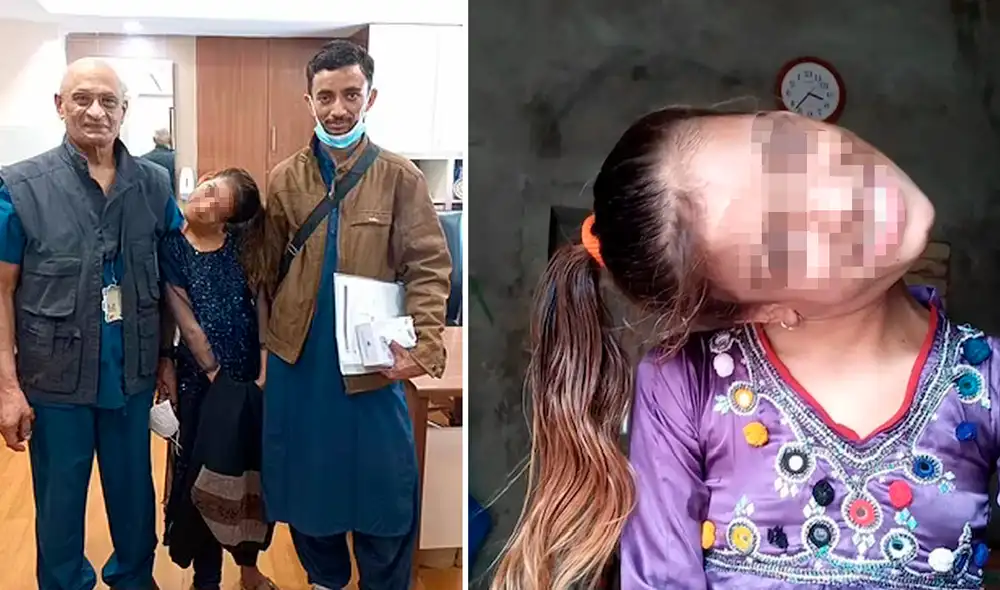 Afsheen Gul vivió prácticamente toda su vida con el cuello en 90 grados. Foto: Instagram/Afsheen Gul