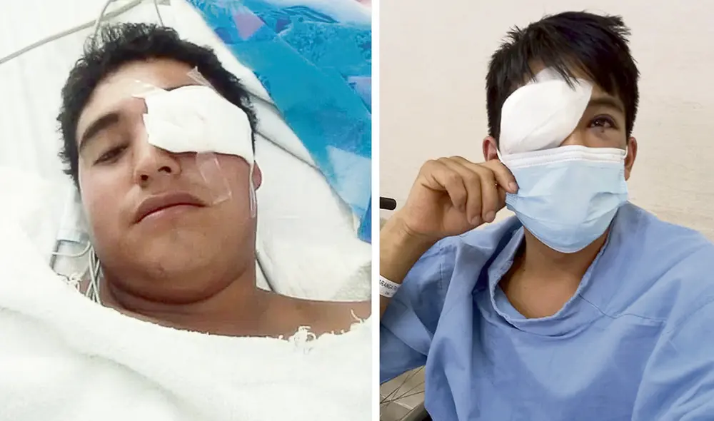 Heridos. Erwin Romero fue operado en Huancayo y Frayan Toribio está en el Almenara.Jauja. Ayer enterraron los restos del adolescente B. J. P. L. Foto: composición/difusión Heridos. Erwin Romero fue operado en Huancayo y Frayan Toribio está en el Almenara.Jauja. Ayer enterraron los restos del adolescente B. J. P. L. Foto: composición/difusión