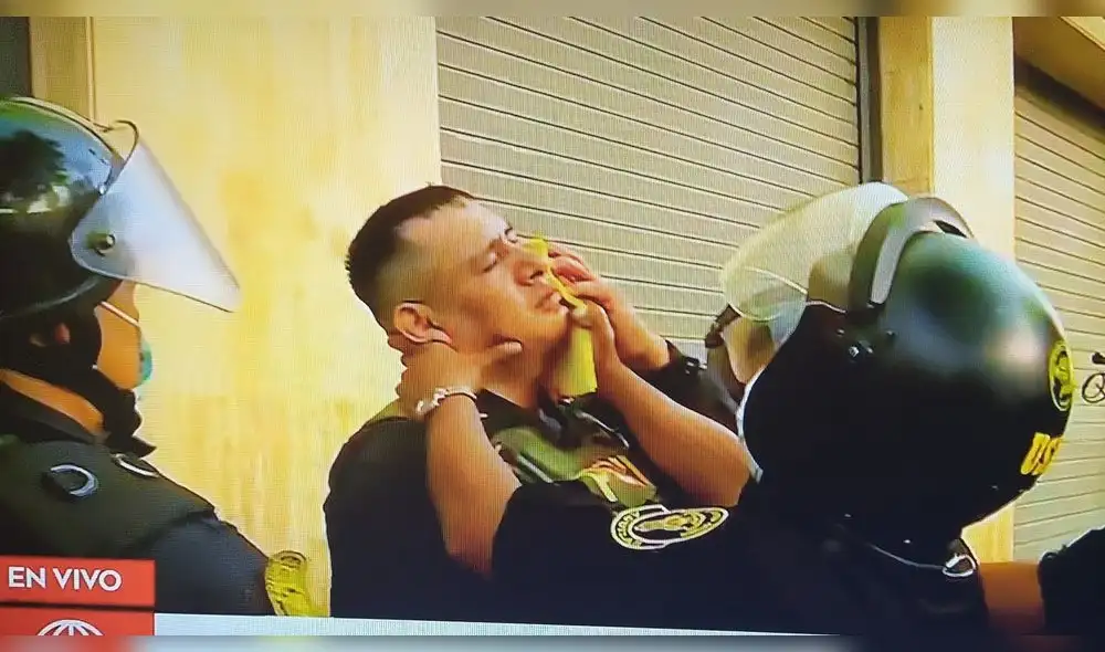 Policía resulta herido tras ser impactado por una piedra en el rostro. Foto: captura América Noticias