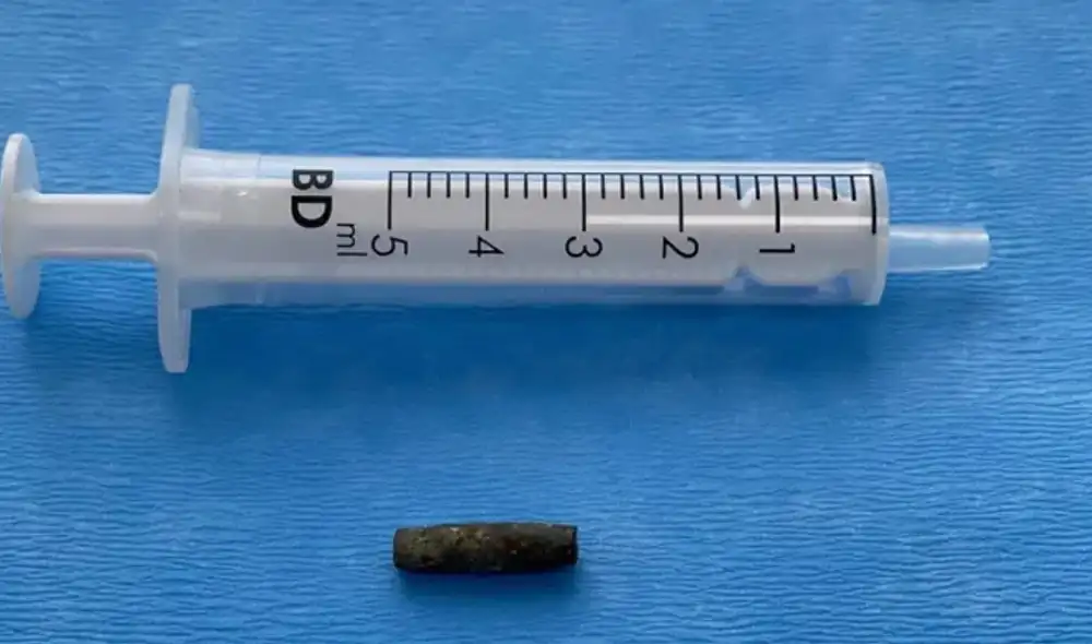 Médicos muestran la bala extraída del corazón del soldado ucraniano. Foto y video: The Sun