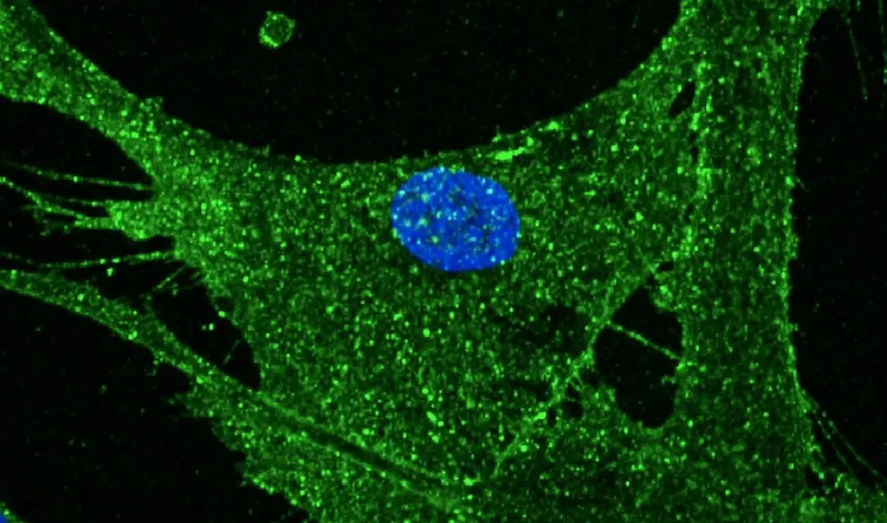 Científicos logran rejuvenecer 30 años células de la piel humana. Foto: BBC Mundo