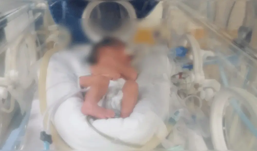 Bebé de 4 días de nacida requiere apoyo para ser trasladada a Lima. Foto: difusión Bebé de 4 días de nacida requiere apoyo para ser trasladada a Lima. Foto: difusión