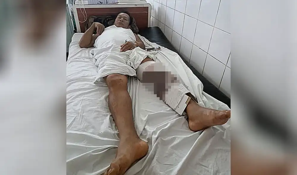 Víctima. Dirigente asháninka Nilson Vargas acusa a Haydée Pampañaupa del atentado. Foto: La República Víctima. Dirigente asháninka Nilson Vargas acusa a Haydée Pampañaupa del atentado. Foto: La República