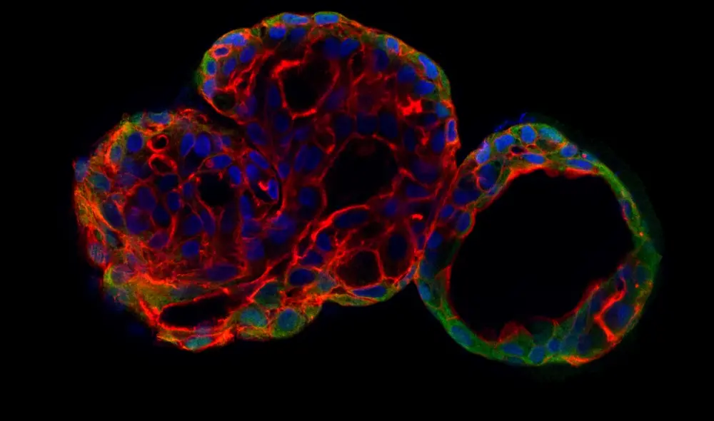 Este nuevo estudio, el mayor sobre datos de secuenciación del genoma completo de tumores, revela un "tesoro escondido" sobre las causas del cáncer. Foto: International Centre for Genetic Engineering and Biotechnology / ICGEB