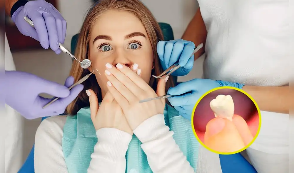 Conoce en qué momento surge la muela del juicio. Foto: composición de Rocío Carvajal/La República