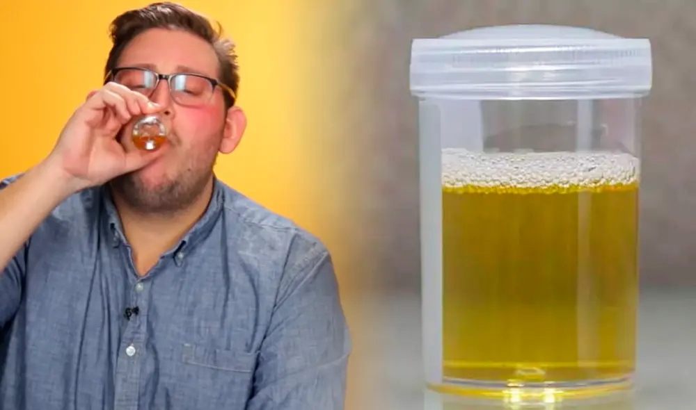 La orina contiene urea, agua, sodio, minerales, ácido úrico y algunas células de la vía urinaria. Foto: composición Fabrizio Oviedo/LR.