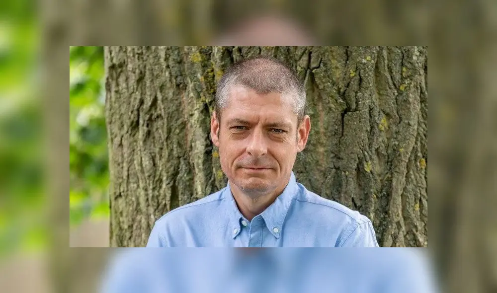 La pandemia de la COVID-19 retrasó la cirugía de "reposición" del miembro alojado en su brazo. Foto: Louis Wood/News Group Newspaper La pandemia de la COVID-19 retrasó la cirugía de "reposición" del miembro alojado en su brazo. Foto: Louis Wood/News Group Newspaper