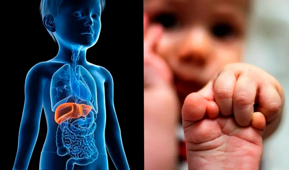 El principal síntoma de esta infección hepática es la ictericia (color amarillento en la piel y ojos). Foto: composición LR