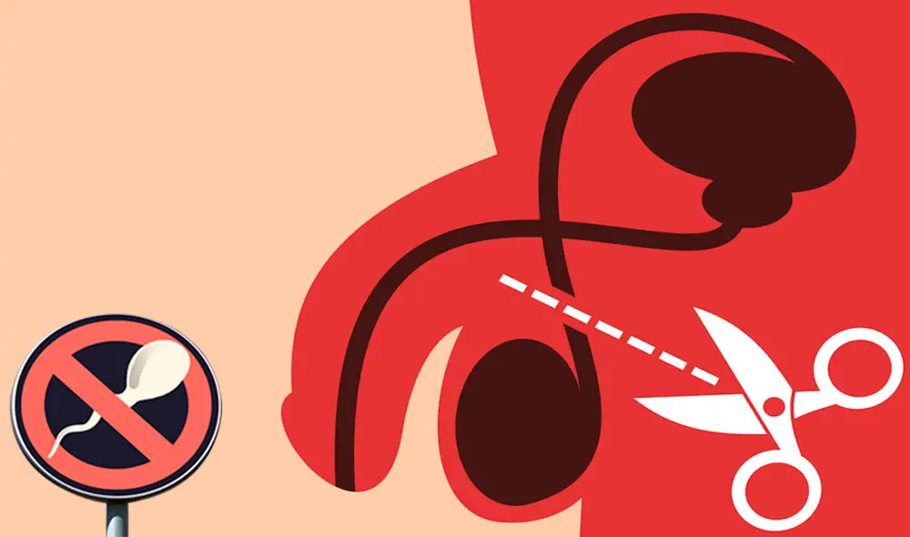 Hasta abril del 2022 se han realizado solo 64 vasectomías, de acuerdo al Minsa. Foto: composición LR Hasta abril del 2022 se han realizado solo 64 vasectomías, de acuerdo al Minsa. Foto: composición LR