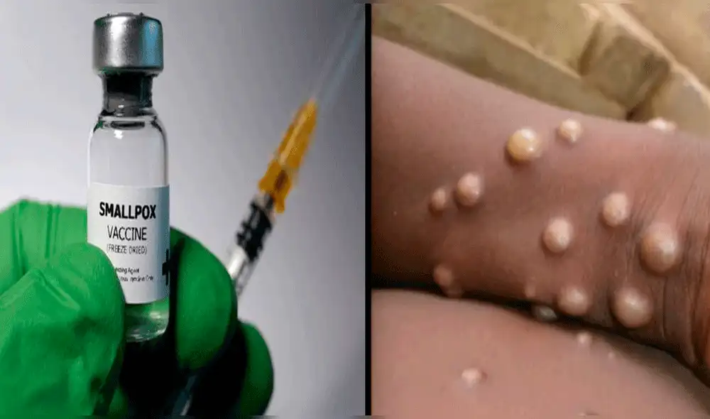 Especialista instó a la ciudadanía a continuar con las medidas sanitarias. Foto: composición / BBC/ OMS Especialista instó a la ciudadanía a continuar con las medidas sanitarias. Foto: composición / BBC/ OMS