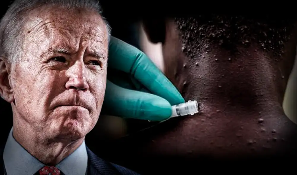 Joe Biden se refirió a la viruela del mono desde Asia. Foto: composición de Jazmin Ceras / La República