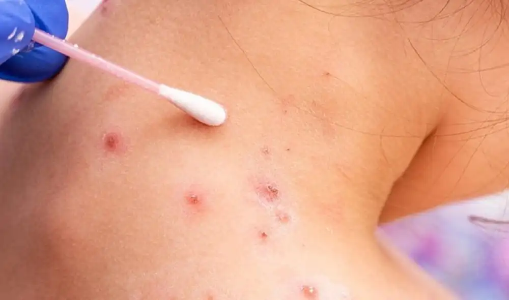 Las autoridades investigan si hay relación entre los casos detectados y si se produjeron más contagios durante los 10 días que duraron los festejos. Foto: AFP Las autoridades investigan si hay relación entre los casos detectados y si se produjeron más contagios durante los 10 días que duraron los festejos. Foto: AFP