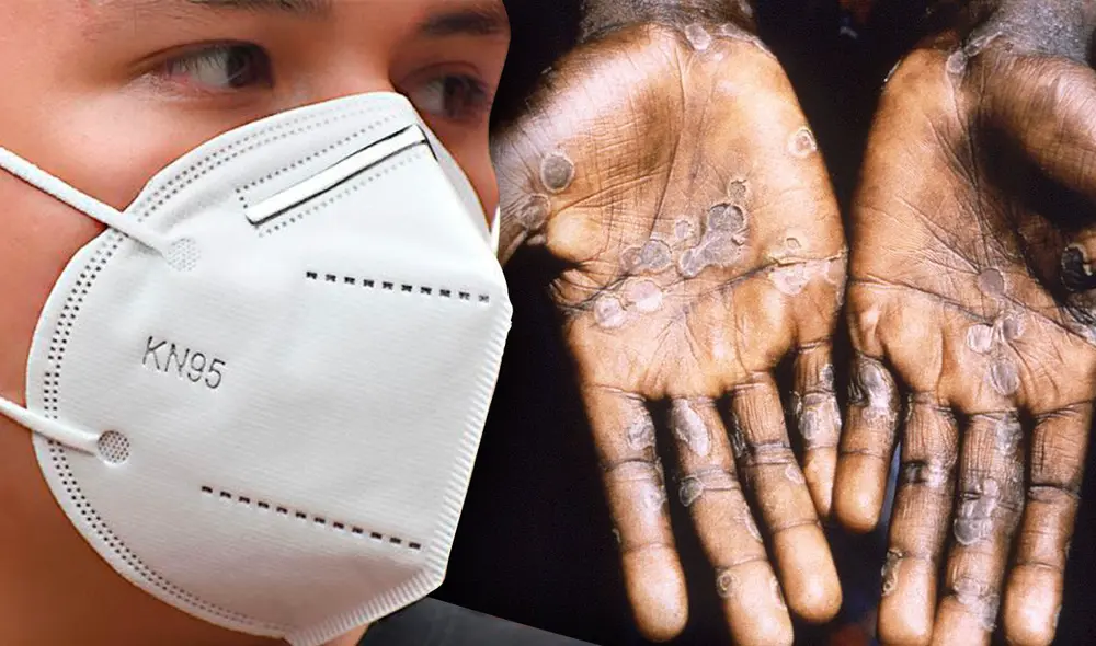 El uso de mascarillas también será de utilidad para prevenir el contagio de la viruela del mono en España. Foto: Composición GLR/ Fabrizio Oviedo