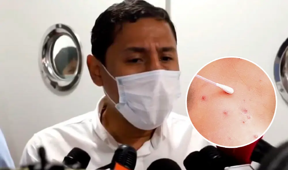 Fernando Pacheco, el secretario de Salud de Santa Cruz, Bolivia, fue al hospital para visitar al paciente. Foto: composición LR / captura de video Correo del Sur / AFP Fernando Pacheco, el secretario de Salud de Santa Cruz, Bolivia, fue al hospital para visitar al paciente. Foto: composición LR / captura de video Correo del Sur / AFP