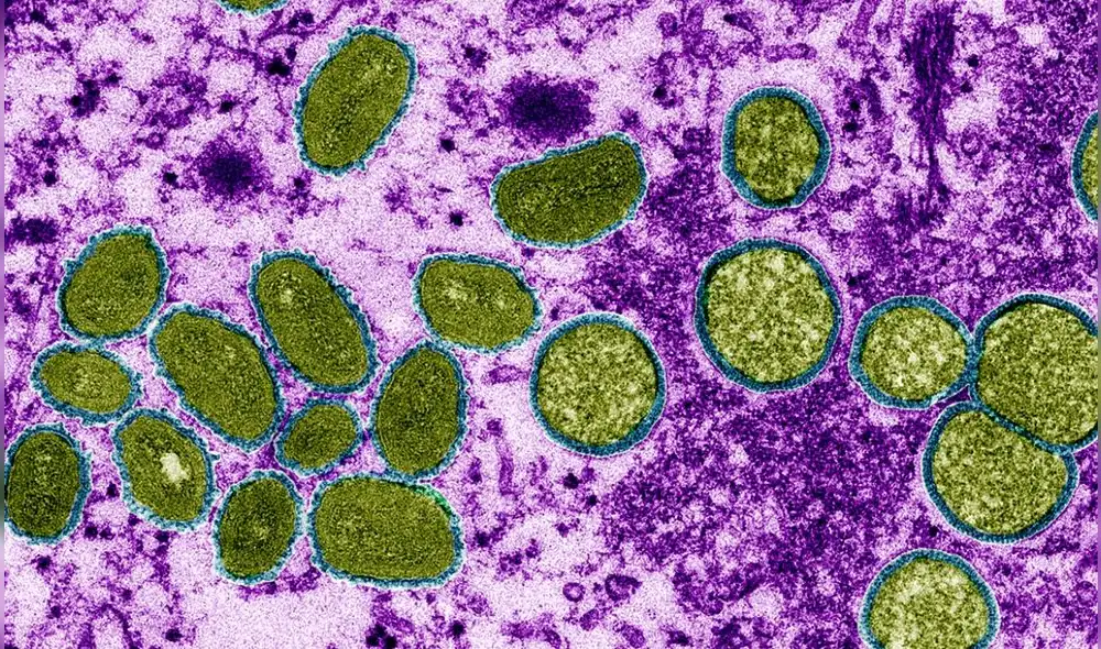 Muestra del virus de la viruela mono (monkeypox, en inglés) bajo el lente de un microscopio electrónico. Foto: CDC / Cynthia S. Goldsmith / Science