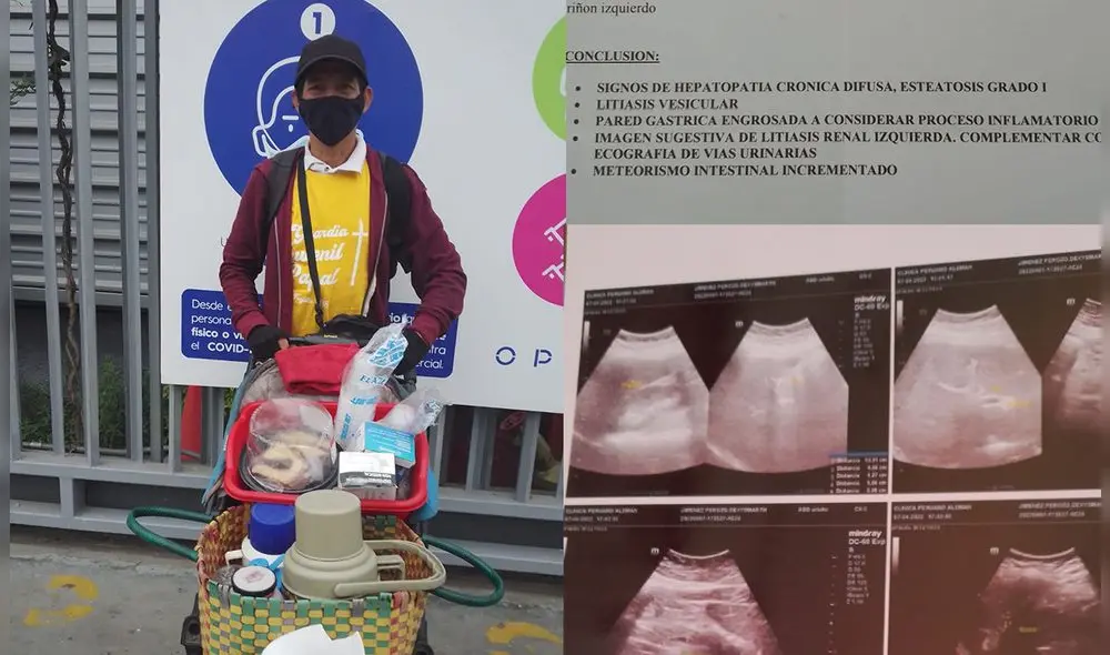 Debido a su condición, la madre de familia solo debe guardar reposo hasta su operación. Foto: composicion/ La República