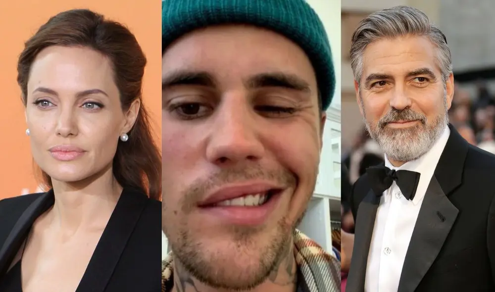 Conoce que otros famosos también sufrieron una parálisis en el rostro. Foto: Composición/Justin Bieber/Instagram