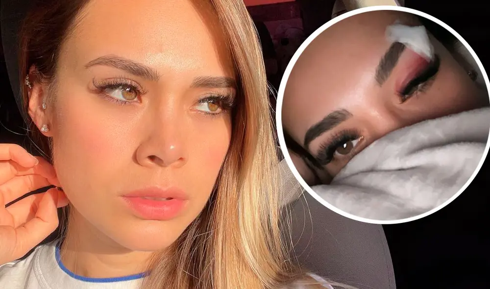 Jossmery Toledo se lastimó durante inauguración de un local. Foto: Instagram