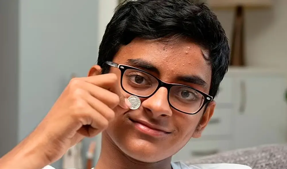 Umair cree que se metió la moneda en la nariz hace una década. Foto: Dailymail