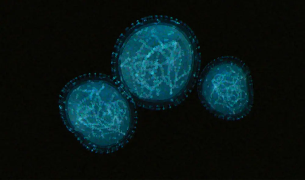 El virus de la viruela del mono tiene un genoma de ADN, por lo que no debería mutar tan rápido. Foto: referencial/Universidad de Hopkins