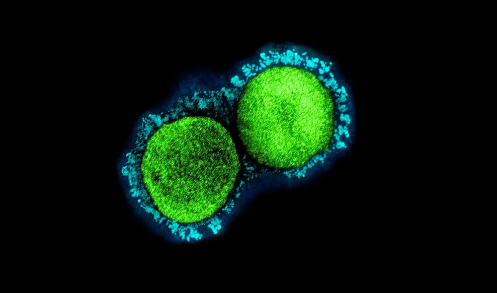 Las subvariantes de ómicron BA.4 y BA.5 están impulsando los contagios en más de 60 países. Foto: NIH/referencial