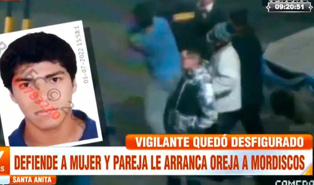 El vigilante afectado aseguró que la comisaría de Santa Anita no le aceptó la denuncia contra Víctor Andrés Falen Sotomarino, pues el presunto agresor ya se había acercado para denunciarlo por agresión. Video: ATV