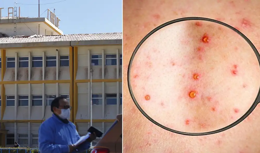 Autoridades informaron que ya se realizó el aislamiento de la persona. Foto: composición LR/archivo La República/referencial /IANS