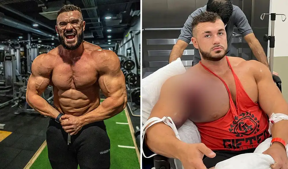 Ryan es fisicoculturista desde los 16 años y cuenta que nunca ha experimentado un dolor así. Foto: composición LR/Instagram: @ryancrowley97