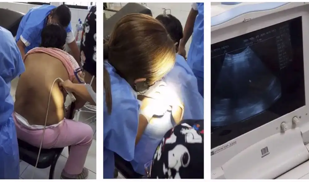 Se trata de la primera intervención de este tipo practicada después de mucho tiempo en el HACH. Foto: composición LR/Minsa