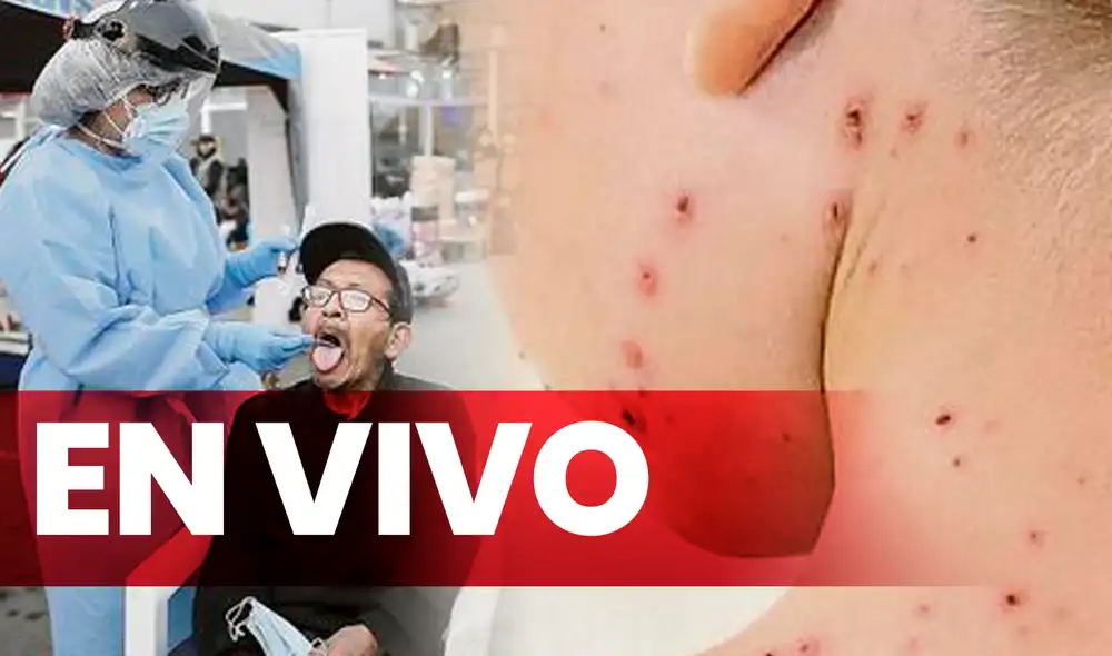 Aumentan los casos de monkeypox y coronavirus en el Perú. Foto: composición LR