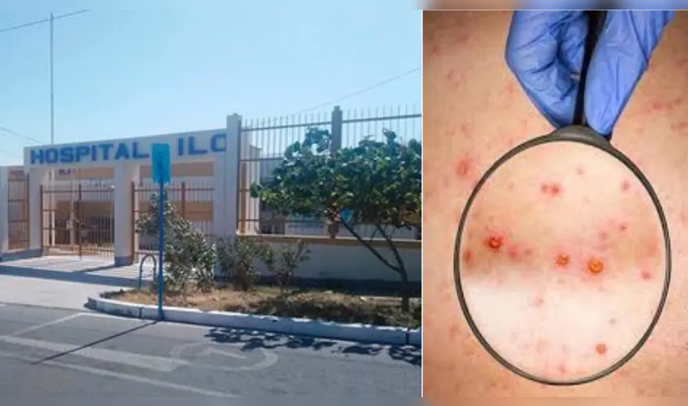 La joven se encuentra aislada en su domicilio y es monitoreada por el personal de salud. Foto: La República/ Archivo