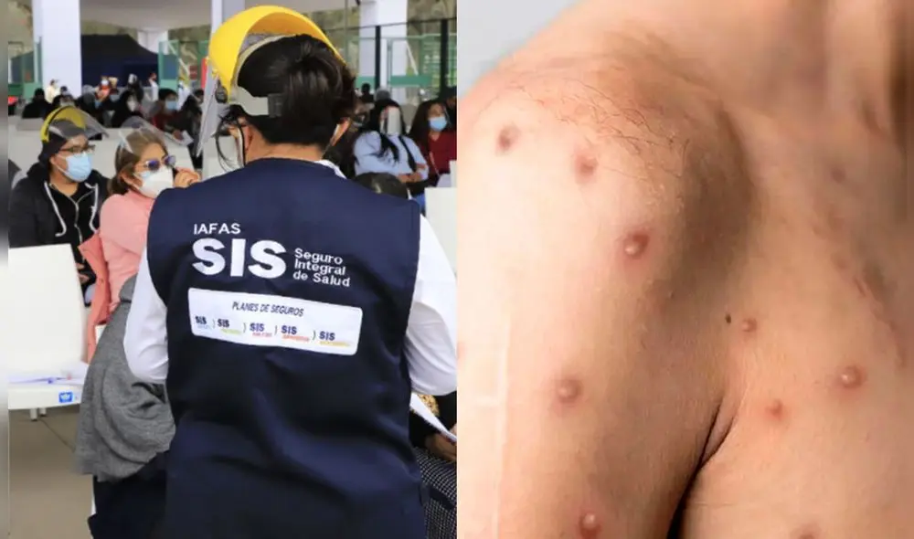 Los pacientes podrán ser atendidos en cualquiera de las fases que se encuentre el virus: leve, moderado o severo. Foto: La República Los pacientes podrán ser atendidos en cualquiera de las fases que se encuentre el virus: leve, moderado o severo. Foto: La República