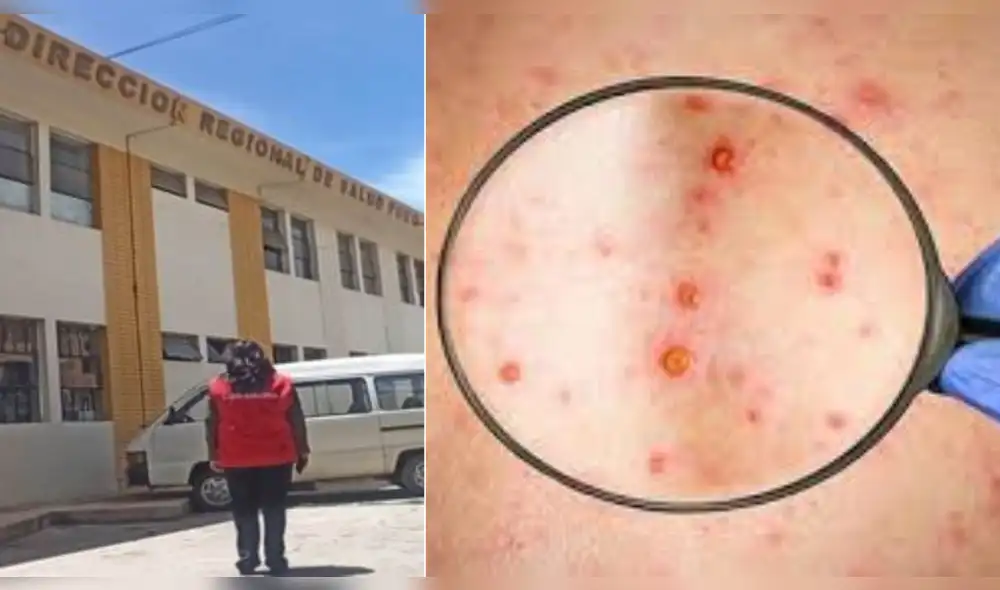 Los resultados de las muestras que se envían a Lima llegan en un plazo de 48 y 72 horas. Foto: composición LR/La República/archivo Los resultados de las muestras que se envían a Lima llegan en un plazo de 48 y 72 horas. Foto: composición LR/La República/archivo