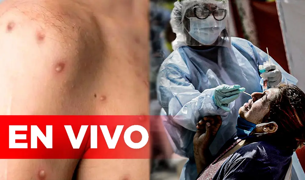 Viruela del mono y cuarta ola de COVID-19. Foto. composición LR / Minsa Viruela del mono y cuarta ola de COVID-19. Foto. composición LR / Minsa