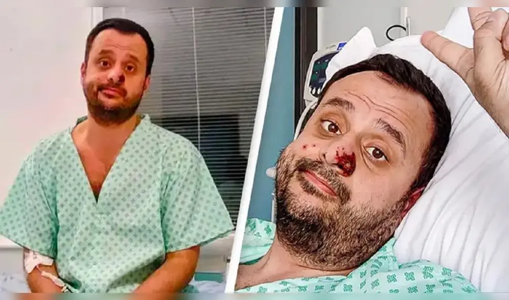 Harun Tulunay estuvo aislado en una habitación de hospital durante semanas después de contraer la viruela del mono. Foto: Harun Tulunay